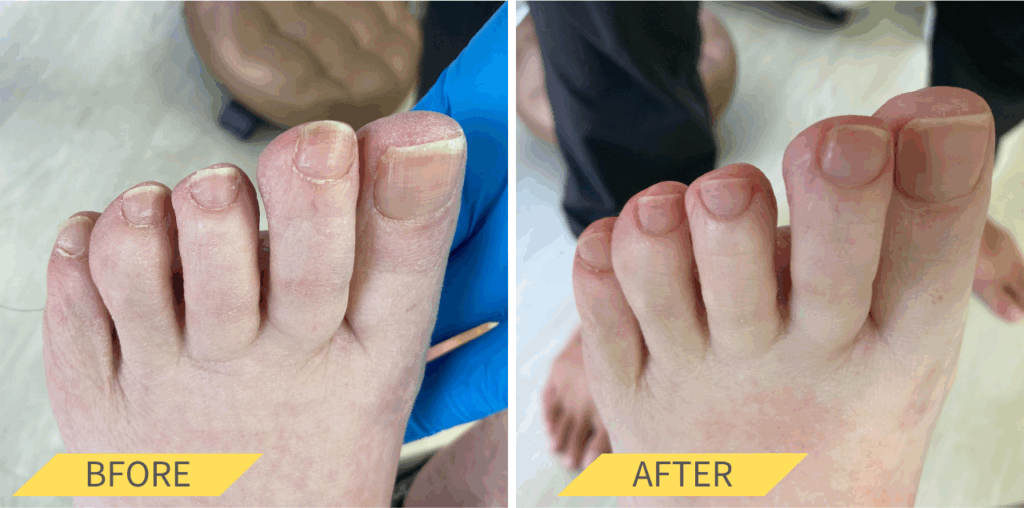 足の爪切り女性